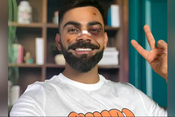 what happened to virat kohli